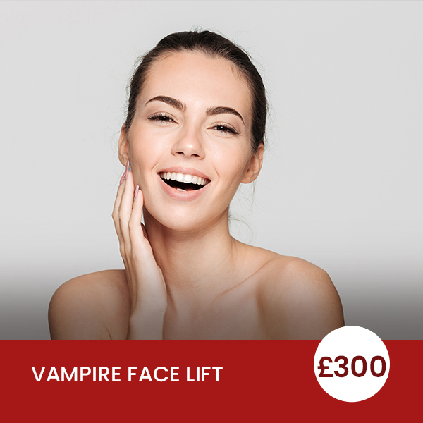 vampire-face-lift